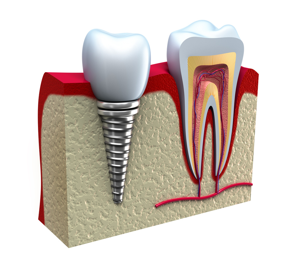 77 - Prótese Dentária